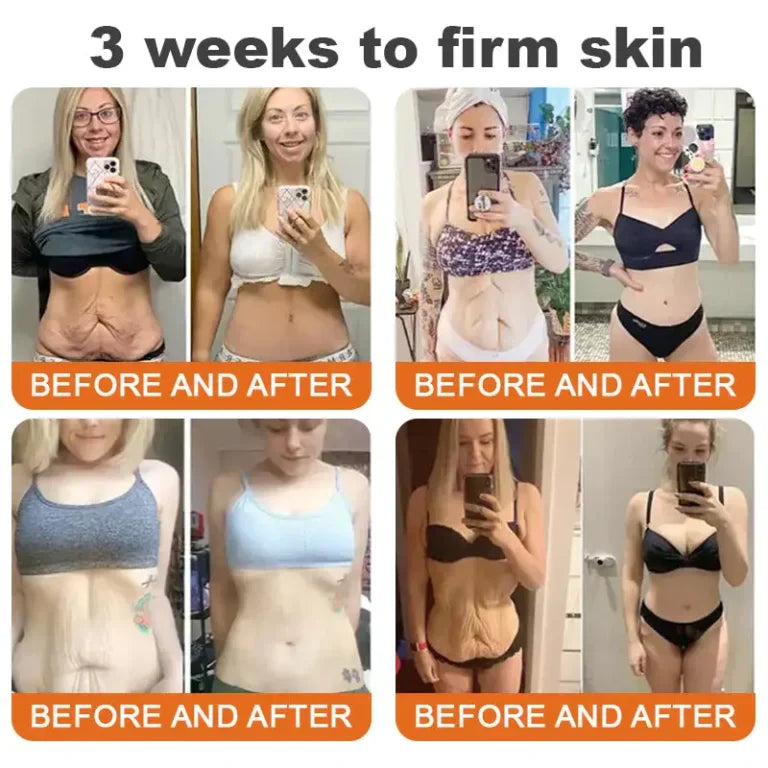 TLOPA® Botox Bee Venom Firming Serum Stick