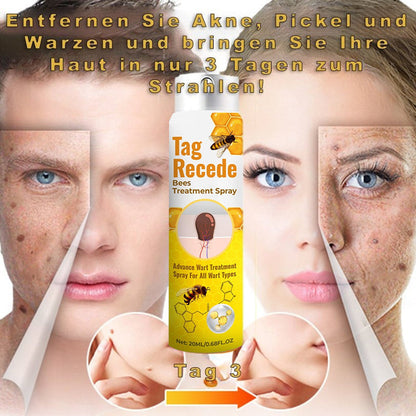 Tagrecede Bees Treatment Spray