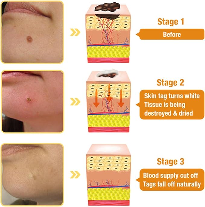 Bee Venom Skin Treatment Cream